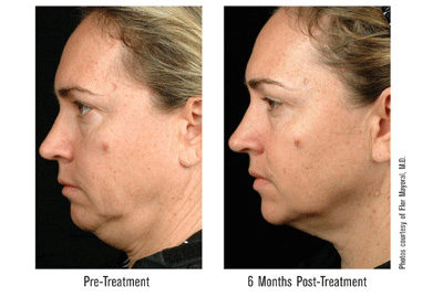 facial contours facial contours